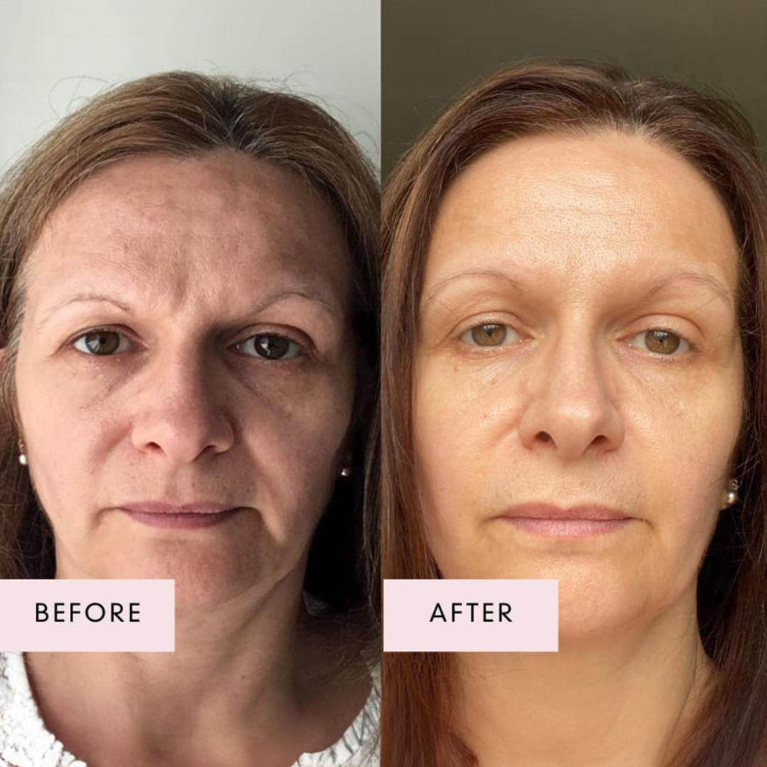 The Menopause Radiance Reset System